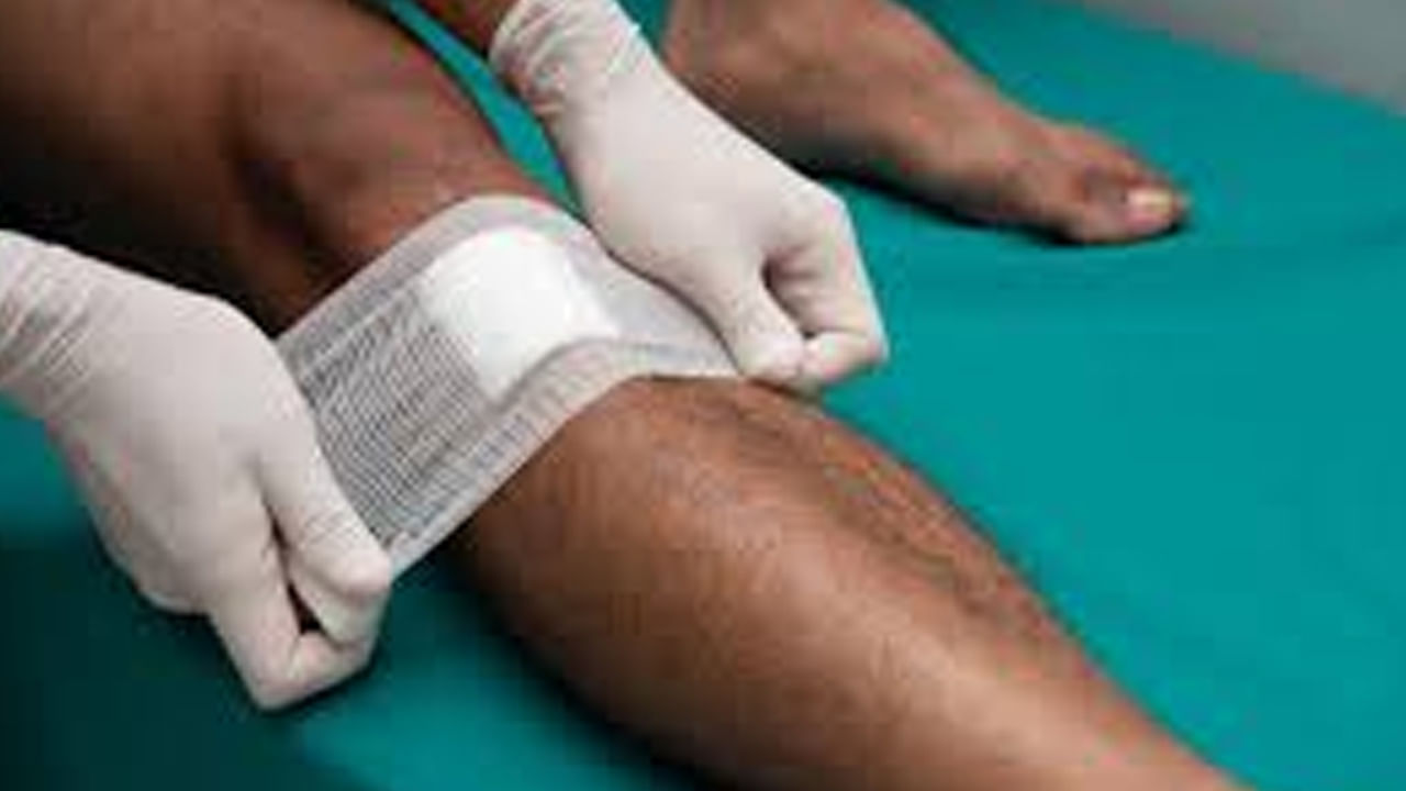 గాయాలు, రక్తస్రావం: గాయపడి రక్తస్రావం ఎక్కువగా ఉంటే.. పటికను ఉపయోగించవచ్చు. పటిక పొడిని కొద్దిగా గాయంపై చల్లడం వల్ల రక్తస్రావం త్వరగా ఆగి ఇన్ఫెక్షన్ రాకుండా చేస్తుంది.