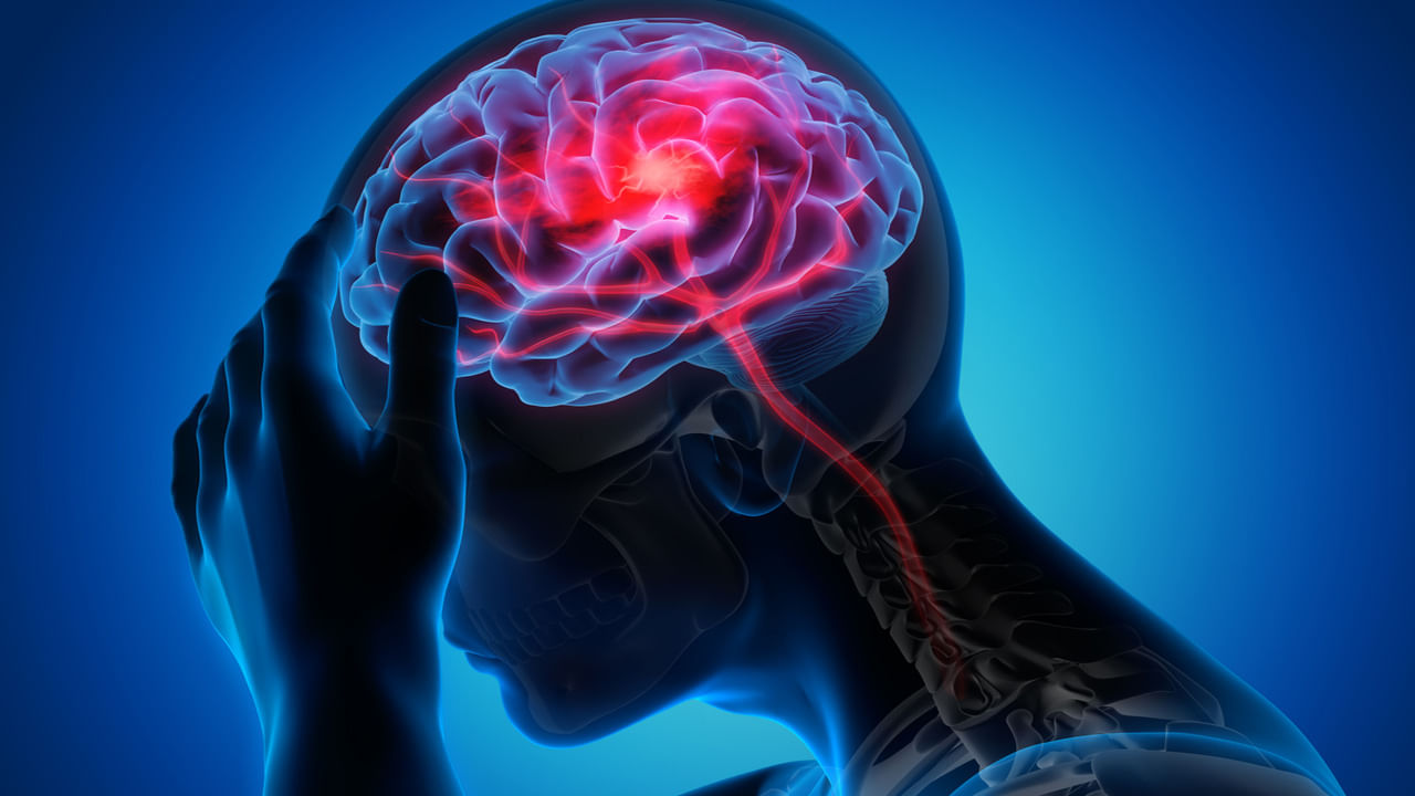 Stroke: స్ట్రోక్‌తో మరో పాతికేళ్లకు 10 మిలియన్ల మరణాలు.. భారతీయులకు హెచ్చరిక!