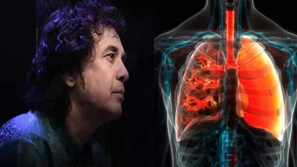 Ustad Zakir Hussain: జాకీర్ హుస్సేన్ ఏ వ్యాధితో మరణించాడో తెలుసా! వృద్దులకు ఈ ఊపిరితిత్తుల వ్యాధి ఎంత ప్రమాదం అంటే..