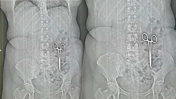 Viral: కడుపునొప్పితో అస్పత్రికొచ్చిన మహిళ.. CT స్కాన్ చేయగా