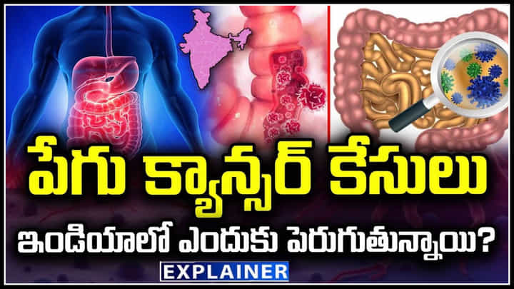 Colon Cancer: పేగు క్యాన్సర్ కేసులు ఇండియాలో ఎందుకు పెరుగుతున్నాయి.? కారణం ఇదేనా.! Colon Cancer: పేగు క్యాన్సర్ కేసులు ఇండియాలో ఎందుకు పెరుగుతున్నాయి.? కారణం ఇదేనా.!