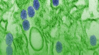 Andhra News: ప్రాణంగా పెంచుకున్న కుక్క మృతి.. ప్రతి ఏడాది దాన్ని జ్ఞాపకాల్లో ఇలా..