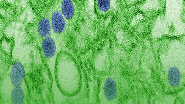 Zika virus: మాయదారి రోగం మళ్లీ దాపురించింది.. నెల్లూరు జిల్లాలో జికా వైరస్ కలకలం..!