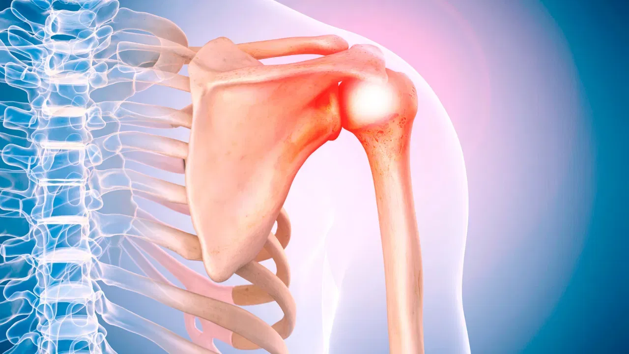 Bones Health 3