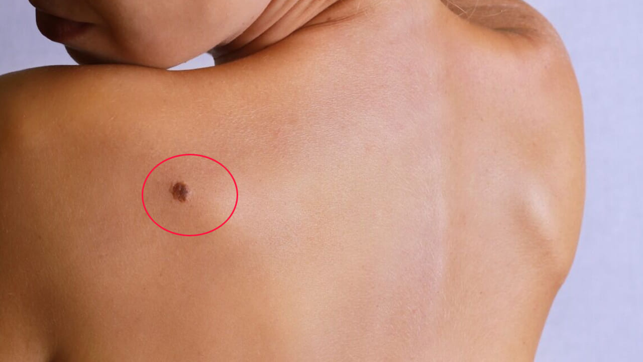 Cancer symptoms: గొంతు బొంగురుపోవడం కూడా క్యాన్సర్కు సంకేతం.. ఈ లక్షణాలను అశ్రద్ద చేయవద్దు