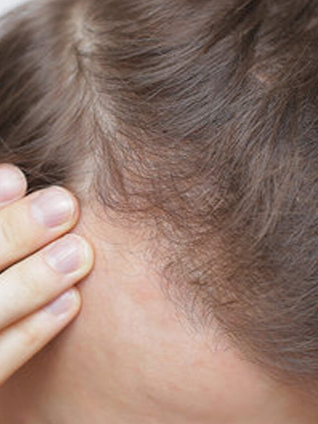 జుట్టు బాగా రాలుతుందా?.. ఈ చిట్కాల‌ను పాటిస్తే చాలు