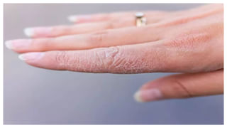 Roasted Chickpeas: వేయించిన శనగలతో గుండె హాయి.. షుగర్ కంట్రోల్!