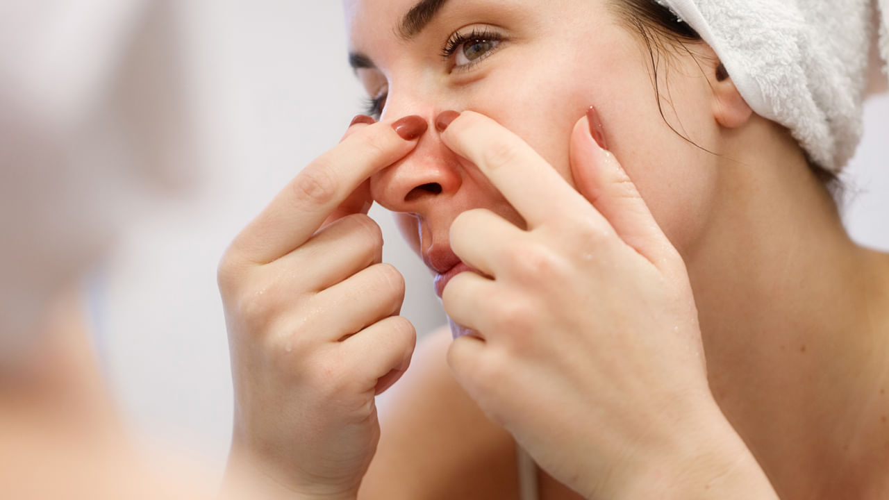 Pimple Remedies 1