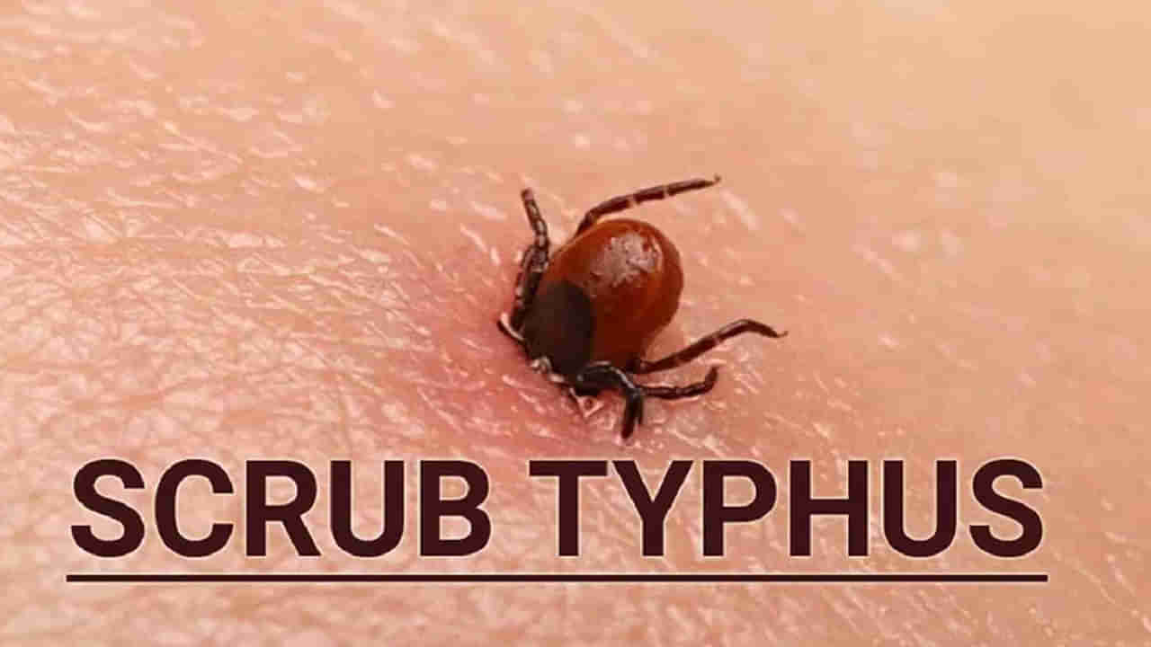 Scrub Typhus: మళ్లీ భయంభయం.. దడ పుట్టిస్తున్న స్క్రబ్ టైఫస్ వ్యాధి! ఎలా వ్యాపిస్తుందో తెలుసా..