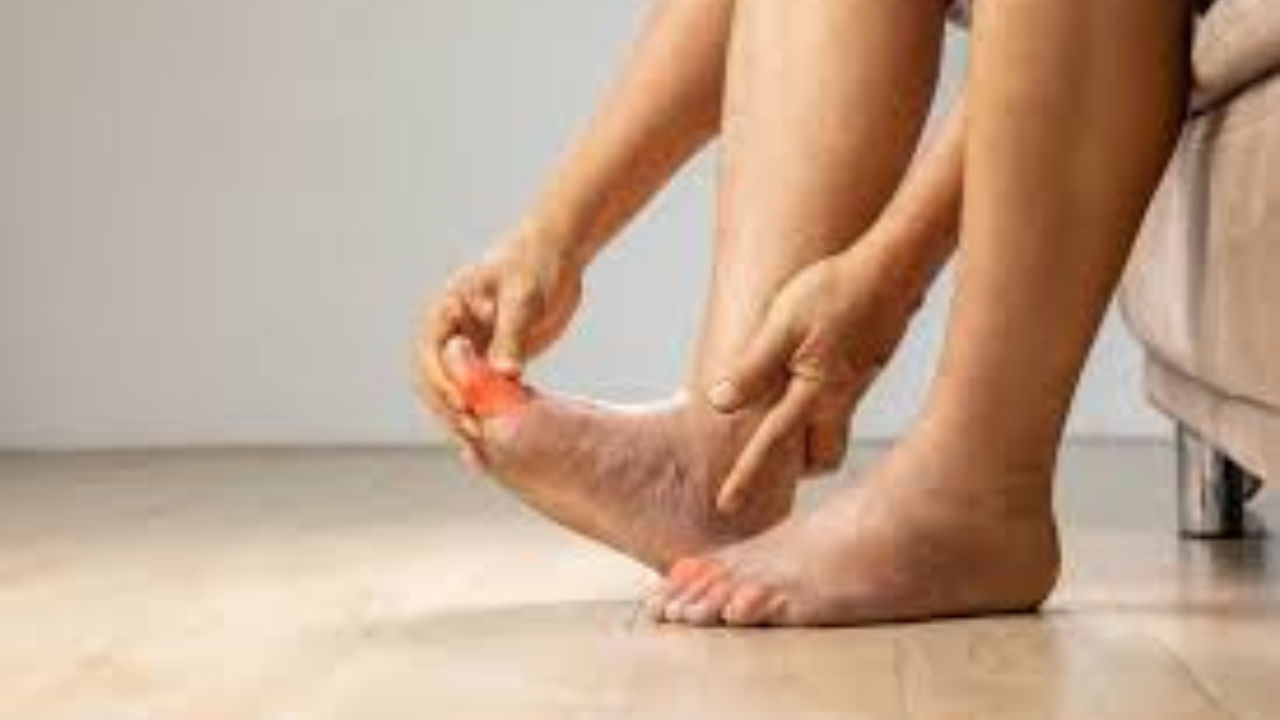 యూరిక్ యాసిడ్ నిర్ధారణ అయిన తర్వాత పాలకూర, టమోటాలు, పప్పులు, గొర్రె మాంసం, చేప నూనె, కాఫీ, కేక్‌లను ఖచ్చితంగా తినకూడదు. అయితే ఈ కింది మూడు పండ్లు తింటే యూరిక్ యాసిడ్ త్వరగా తగ్గుతుంది. వాటిల్లో మొదటిది చెర్రీస్‌.. వీటిల్లో యాంటీఆక్సిడెంట్లు పుష్కలంగా ఉంటాయి. ఇవి శరీర నొప్పులను తగ్గిస్తుంది. అంతే కాదు ఈ పండు యూరిక్ యాసిడ్‌ను తగ్గించడంలో కూడా సహాయపడుతుంది.