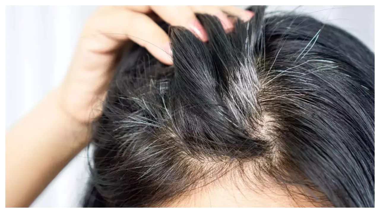 White Hair Remedies: ఈ ఒక్క పేస్టు వాడండి.. తెల్లజుట్టు మాయం అవుతుంది..