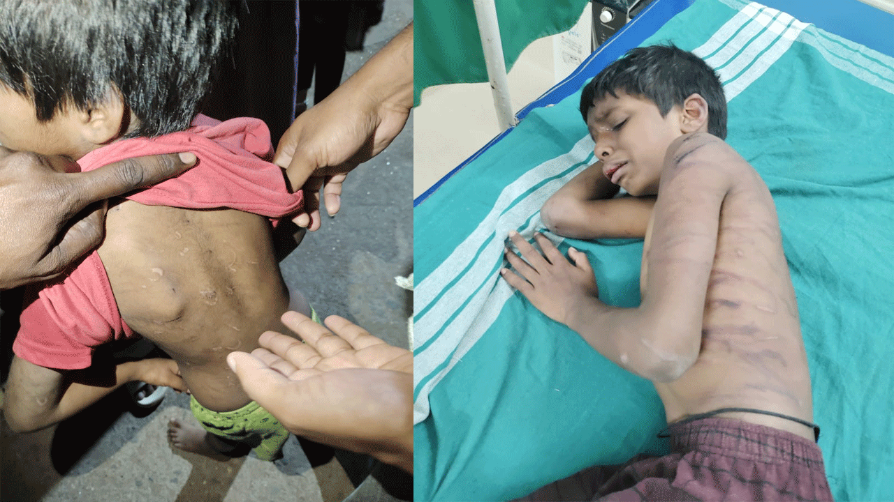 Video: మనుషులా.. మృగాలా.. ఇద్దరు చిన్నారులపై విచక్షణా రహితంగా దాడి