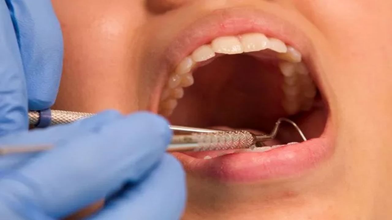 Dental hygiene: రోజువారీ జీవితంలో చేసే ఈ చిన్న పొరబాటు.. స్ట్రోక్ ప్రమాదాన్ని పెంచుతుందట!