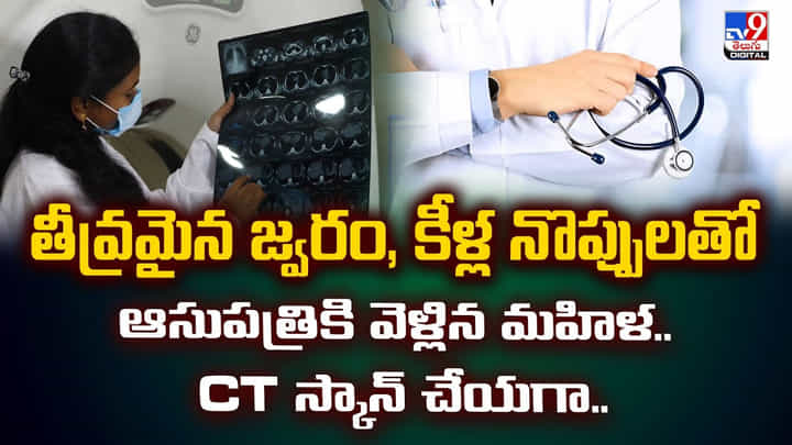 తీవ్రమైన జ్వరం, కీళ్ల నొప్పులతో ఆసుపత్రికి వెళ్లిన మహిళ.. CT స్కాన్ చేయగా తీవ్రమైన జ్వరం, కీళ్ల నొప్పులతో ఆసుపత్రికి వెళ్లిన మహిళ.. CT స్కాన్ చేయగా