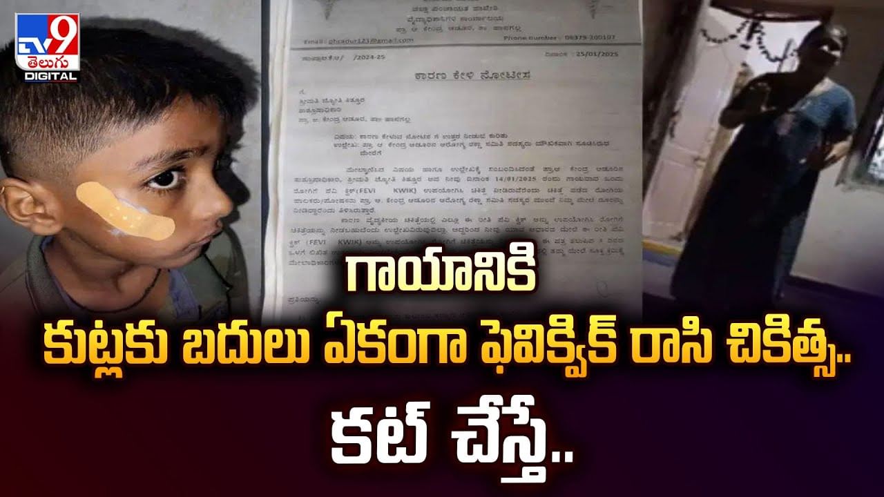 గాయానికి కుట్లకు బదులు ఏకంగా ఫెవిక్విక్‌ రాసి చికిత్స.. కట్ చేస్తే..