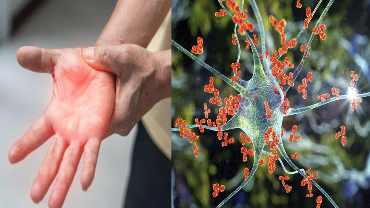 Guillain-Barre Syndrome: ఏపీలో తొలి జీబీఎస్ మరణం.. చికిత్స పొందుతూ మహిళ మృతి..