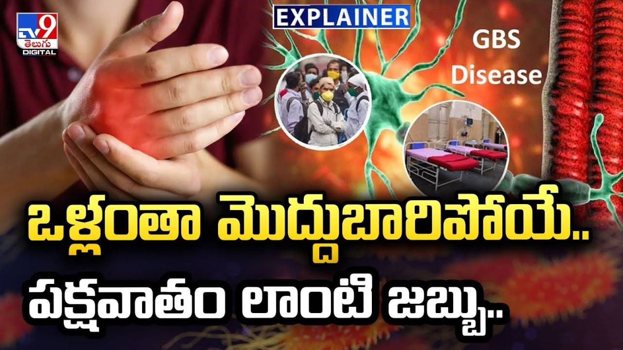 ఒళ్లంతా మొద్దుబారిపోయే.. పక్షవాతం లాంటి జబ్బు..