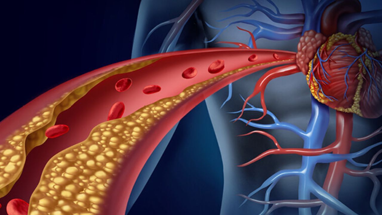 అధిక కొలెస్ట్రాల్ వల్ల గుండె ఆరోగ్యానికి ముప్పు..! వైద్య నిపుణులు ఏం చెబుతున్నారంటే..!