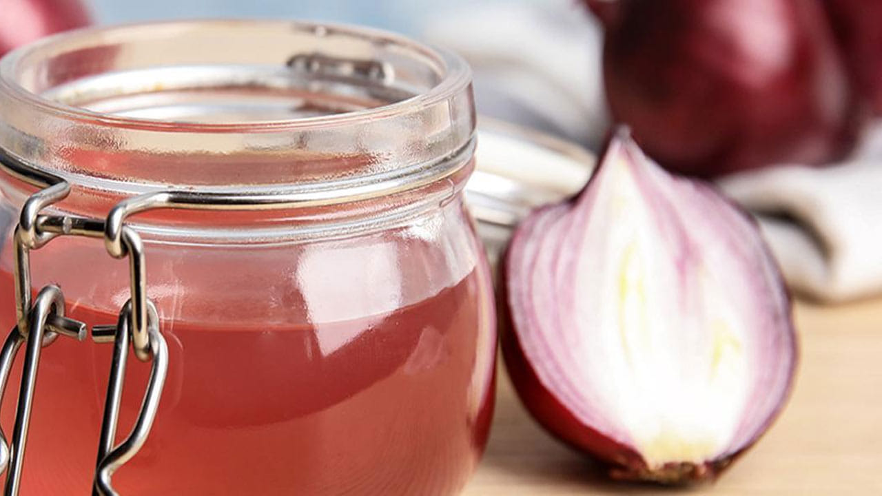 ఉల్లిలో యాంటీ బాక్టీరియల్, యాంటీ ఫంగల్ లక్షణాలు పుష్కలంగా ఉంటాయి. ఇవి చుండ్రును నయం చేయడంలో సహాయపడతాయి. అంతేకాకుండా జుట్టుకు ఉల్లి రసాన్ని అప్లై చేయడం వల్ల జుట్టు మరింత మెరుస్తూ, మృదువుగా మారుతుంది. షాంపూ చేయడానికి ముందు ఉల్లి రసాన్ని జుట్టుకు అప్లై చేస్తే.. తలకు రక్త ప్రసరణ పెరుగుతుంది. జుట్టు రాలడాన్ని నివారిస్తుంది. జుట్టును ఒత్తుగా మార్చడంలో సహాయపడుతుంది.