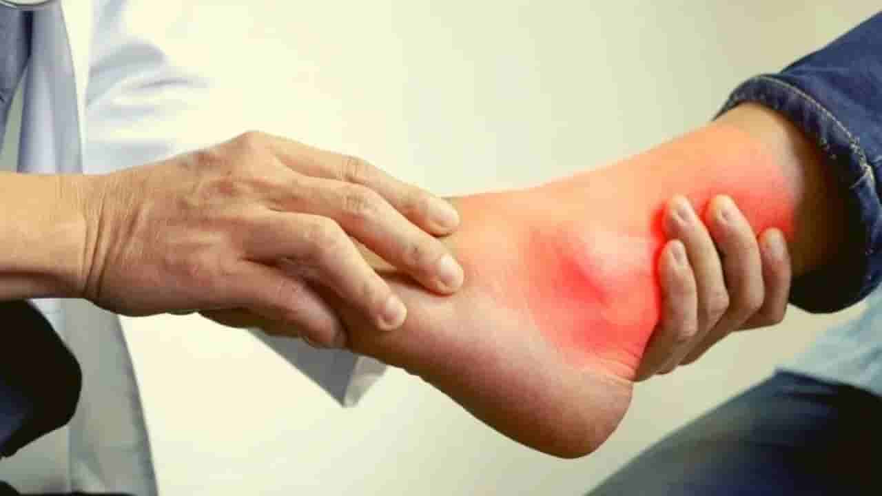 యూరిక్ యాసిడ్​ ఎక్కువై ఇబ్బంది పడుతున్నారా..?  తినే ఆహారం విషయంలో ఈ పొరపాట్లు చేయకండి..!