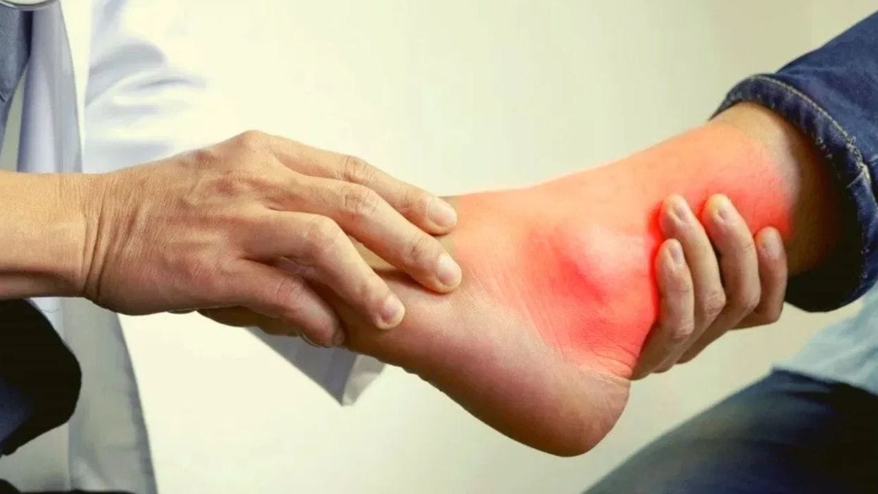 యూరిక్ యాసిడ్​ ఎక్కువై ఇబ్బంది పడుతున్నారా..?  తినే ఆహారం విషయంలో ఈ పొరపాట్లు చేయకండి..!