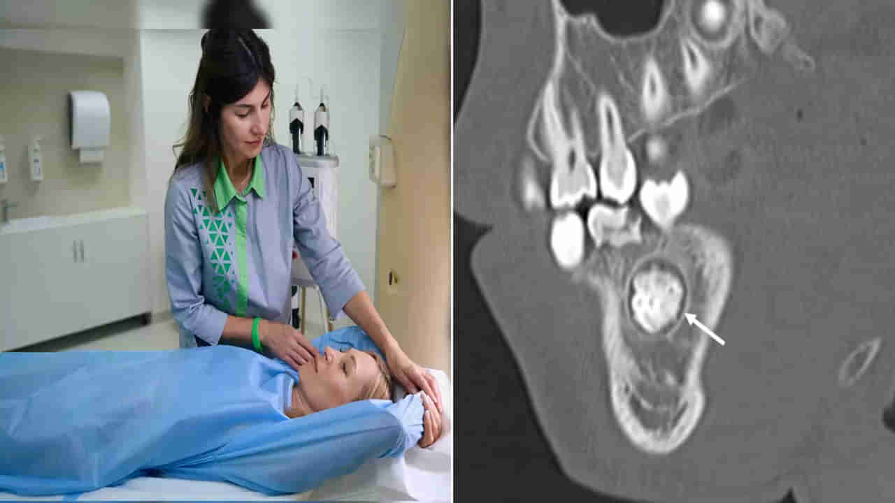 Viral: పంటి నొప్పితో ఆస్పత్రికొచ్చి ప్రాణాలు కోల్పోయింది.. డాక్టర్లు CT స్కాన్ చేయగా