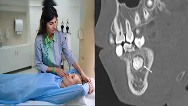 Viral: పంటి నొప్పితో ఆస్పత్రికొచ్చి ప్రాణాలు కోల్పోయింది.. డాక్టర్లు CT స్కాన్ చేయగా