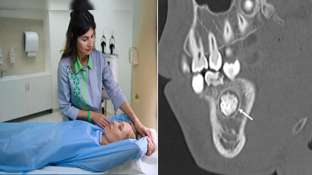 Viral: పంటి నొప్పితో ఆస్పత్రికొచ్చి ప్రాణాలు కోల్పోయింది.. డాక్టర్లు CT స్కాన్ చేయగా