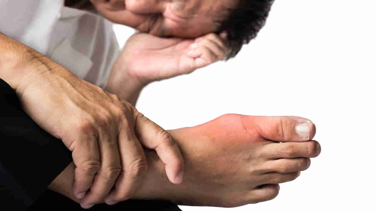 ఇలాంటి పండ్లు ఆరోగ్యానికి అమృతమే..! కీళ్లలోని యూరిక్ యాసిడ్, ఆర్థరైటిస్‌ నొప్పులకు ఇట్టే చెక్‌ పెట్టొచ్చు..!!