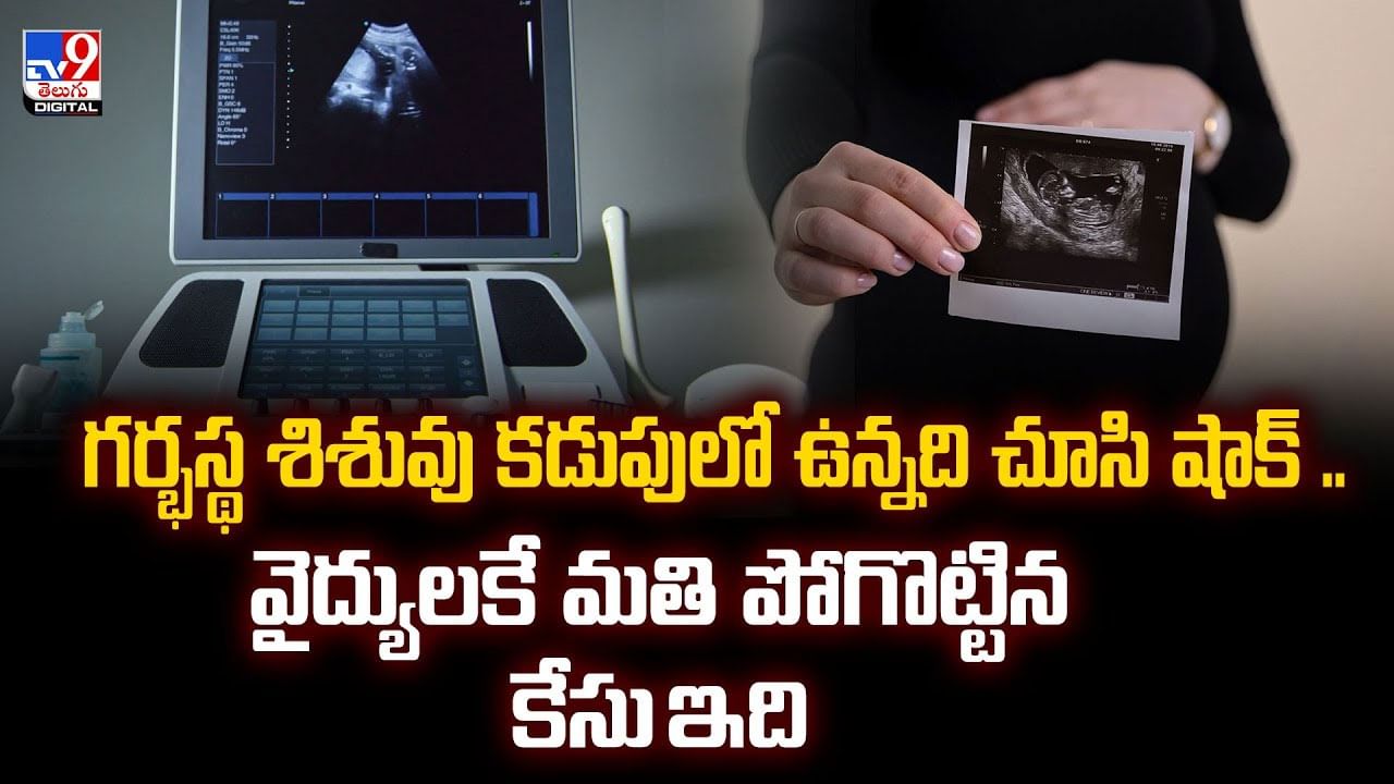 గర్భస్థ శిశువు కడుపులో ఉన్నది చూసి షాక్‌ .. వైద్యులకే మతి పోగొట్టిన కేసు ఇది