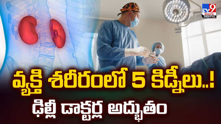 వ్యక్తి శరీరంలో 5 కిడ్నీలు..ఢిల్లీ డాక్టర్ల అద్భుతం వీడియో వ్యక్తి శరీరంలో 5 కిడ్నీలు..ఢిల్లీ డాక్టర్ల అద్భుతం వీడియో