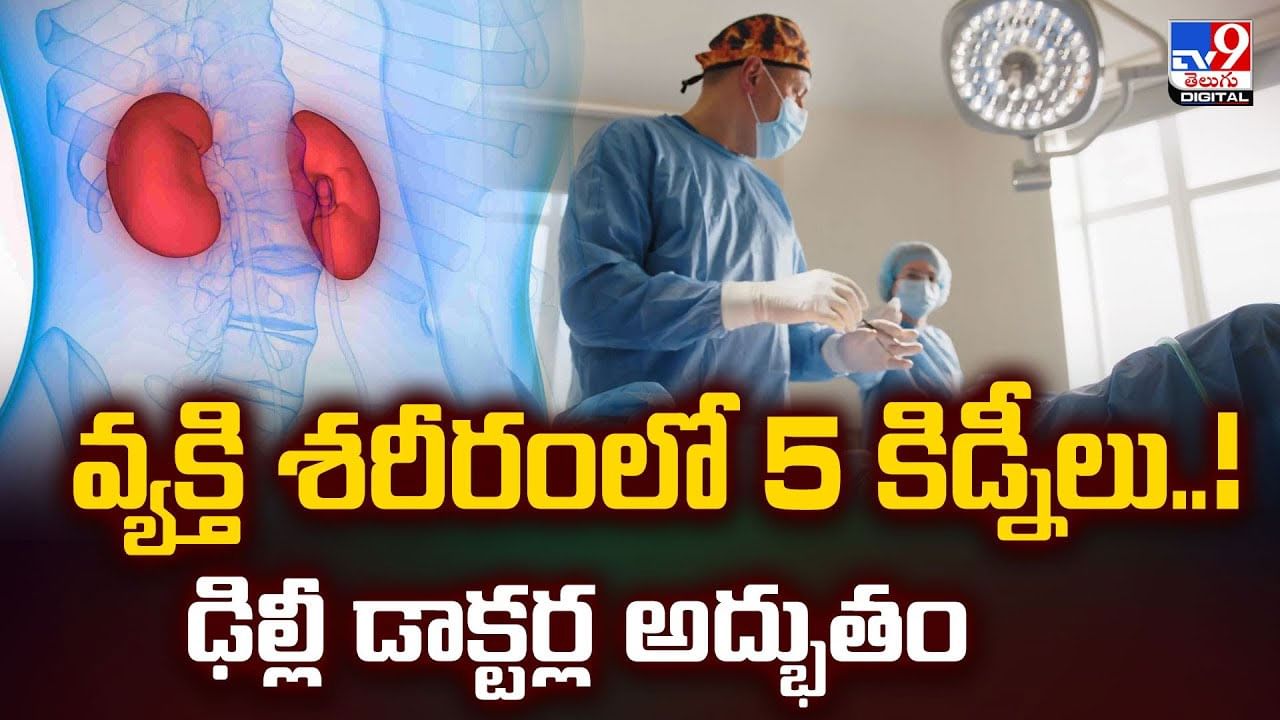 వ్యక్తి శరీరంలో 5 కిడ్నీలు..ఢిల్లీ డాక్టర్ల అద్భుతం వీడియో