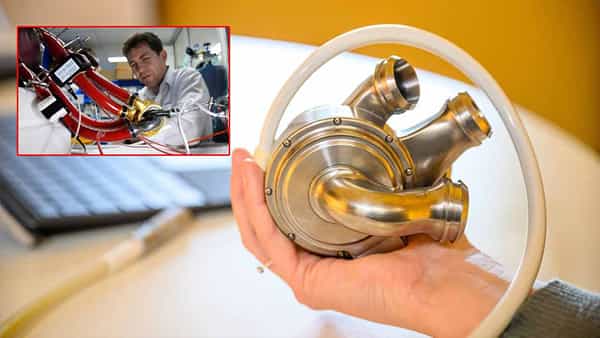 BiVACOR Heart: వైద్య చరిత్రలో మరో అద్భుతం.. కృత్రిమ గుండెతో 100 రోజులు బతికిన రోగి!