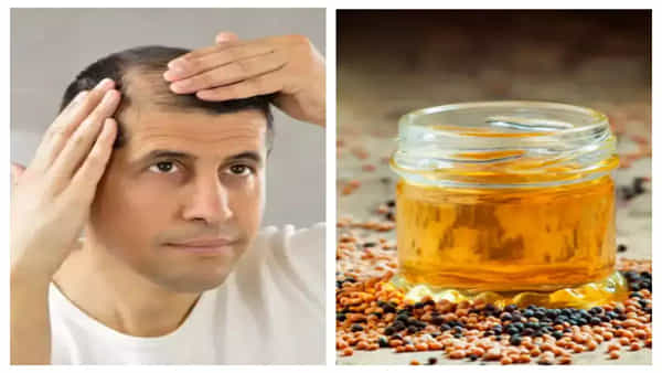Hair Loss: రూపాయి ఖర్చులేకుండా జుట్టు రాలే సమస్యకు రామబాణం.. ఈ నూనెను ఎలా వాడాలంటే..