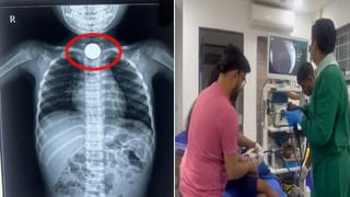 Telangana: కలిసి జీవించలేమనుకున్న ఓ జంట.. మరణంతో ఒకటయ్యారు..!