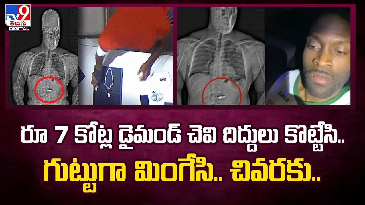 రూ 7 కోట్ల డైమండ్ చెవి దిద్దులు కొట్టేసి.. గుట్టుగా మింగేసి.. చివరకు