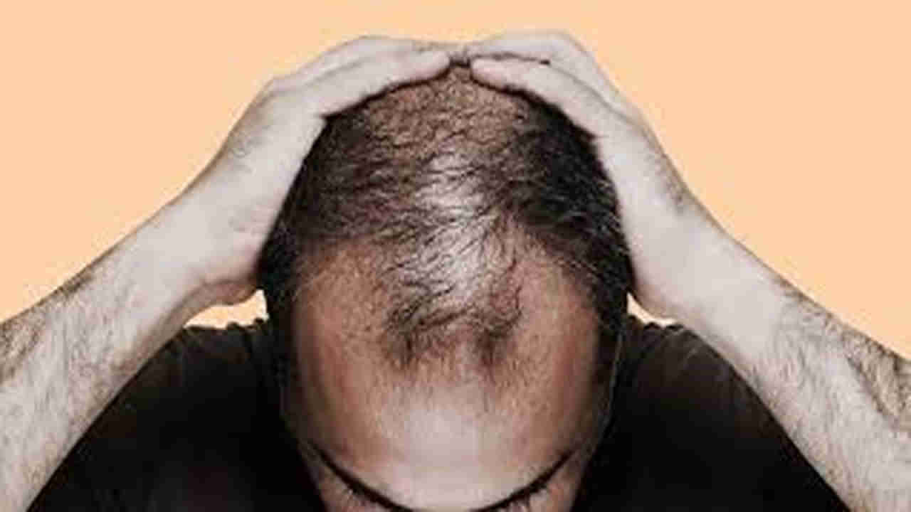 బట్టతలపై వెంట్రుకలు మొలిపిస్తామంటే పోయారు.. ఆ తర్వాత 67 మంది ఆస్పత్రి పాలయ్యారు