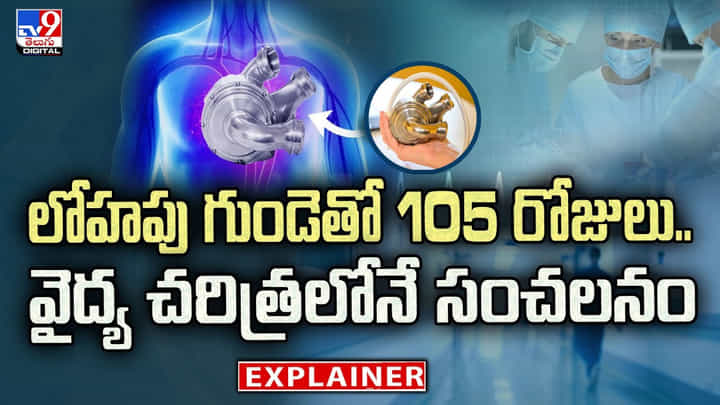 లోహపు గుండెతో 105 రోజులు.. వైద్య చరిత్రలోనే సంచలనం లోహపు గుండెతో 105 రోజులు.. వైద్య చరిత్రలోనే సంచలనం