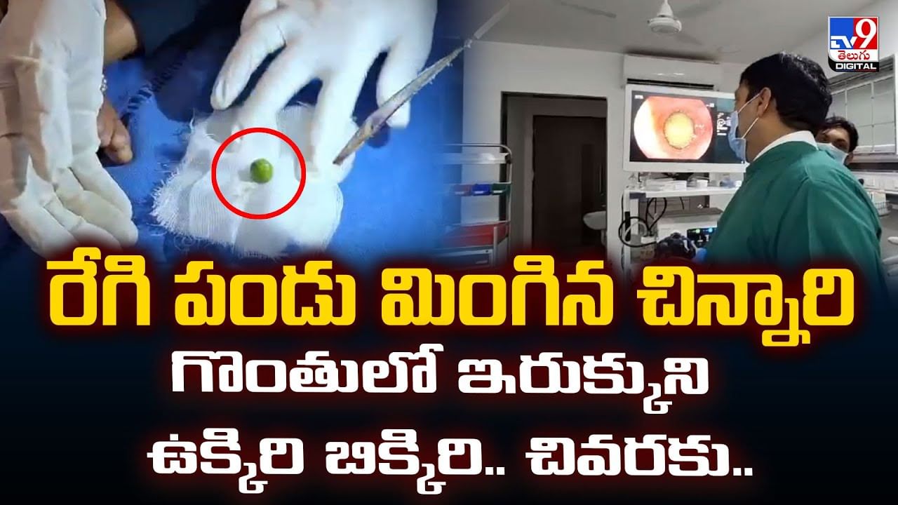 రేగి పండు మింగిన చిన్నారి గొంతులో ఇరుక్కుని ఉక్కిరి బిక్కిరి.. చివరకు