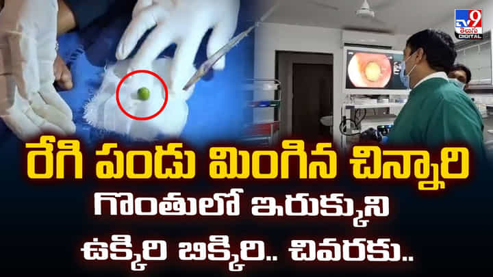 రేగి పండు మింగిన చిన్నారి గొంతులో ఇరుక్కుని ఉక్కిరి బిక్కిరి.. చివరకు రేగి పండు మింగిన చిన్నారి గొంతులో ఇరుక్కుని ఉక్కిరి బిక్కిరి.. చివరకు