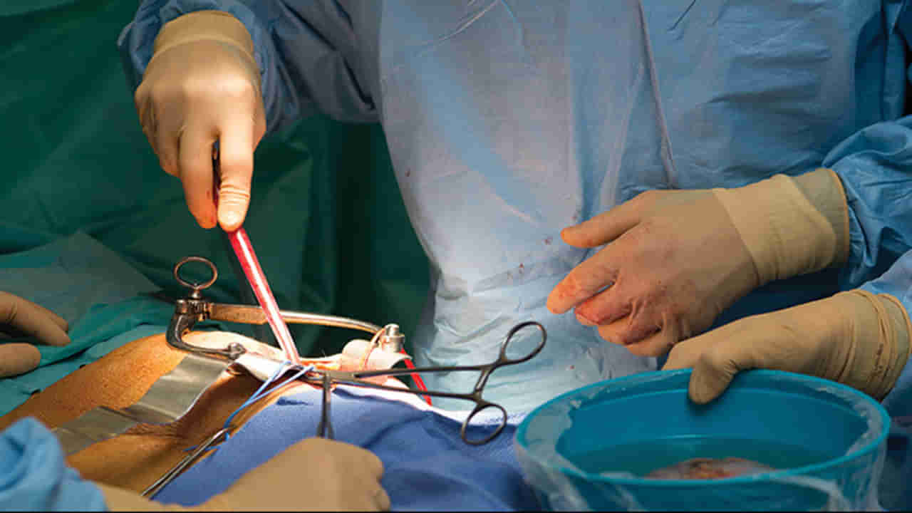 Vijayawada: మహిళకు మూడు సార్లు కిడ్నీ మార్పిడి.. దాతలంతా కుటుంబ సభ్యులే