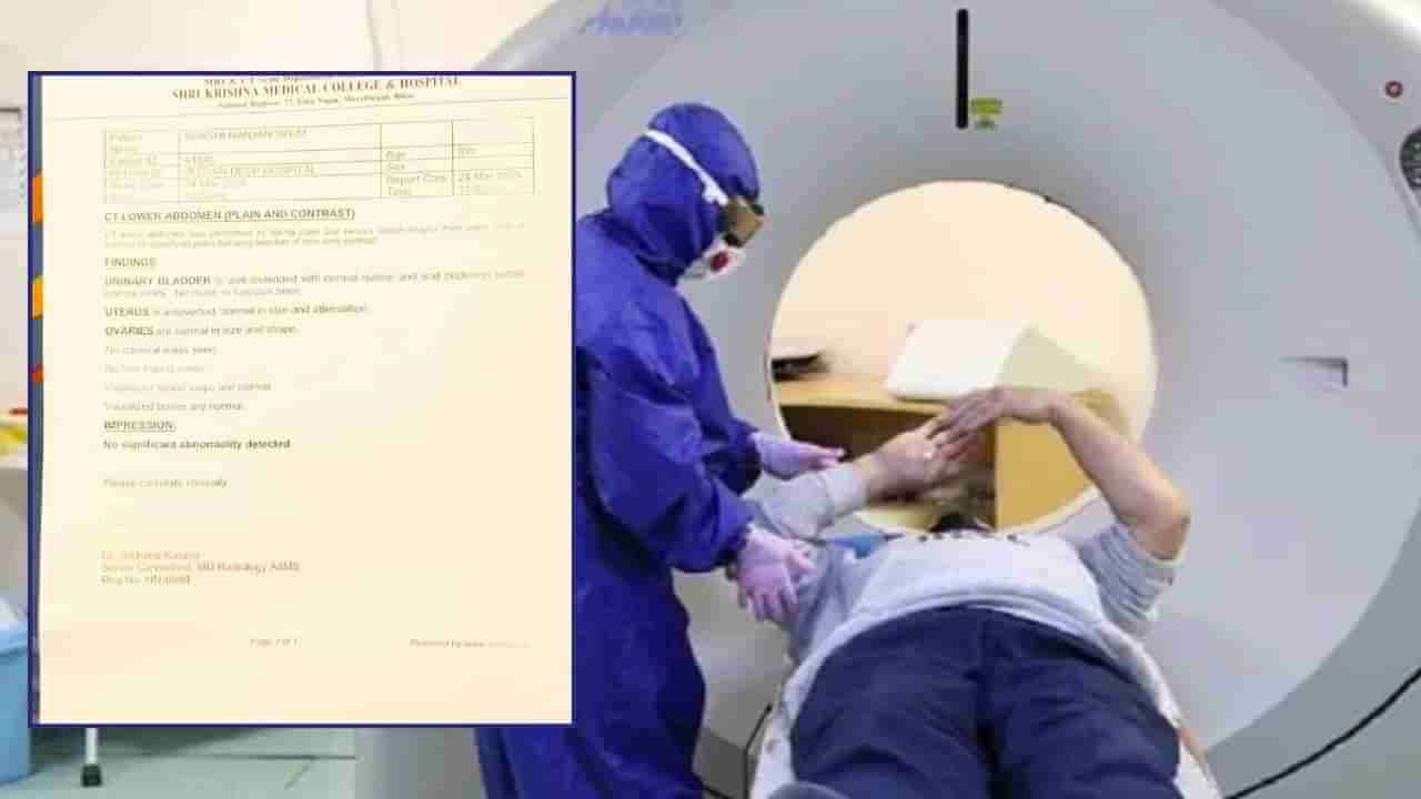 అనారోగ్యంతో CT స్కాన్ చేయించుకున్న వ్యక్తి.. కడుపులో గర్భాశయం చూసి స్టన్.. ట్విస్ట్ ఇదే!
