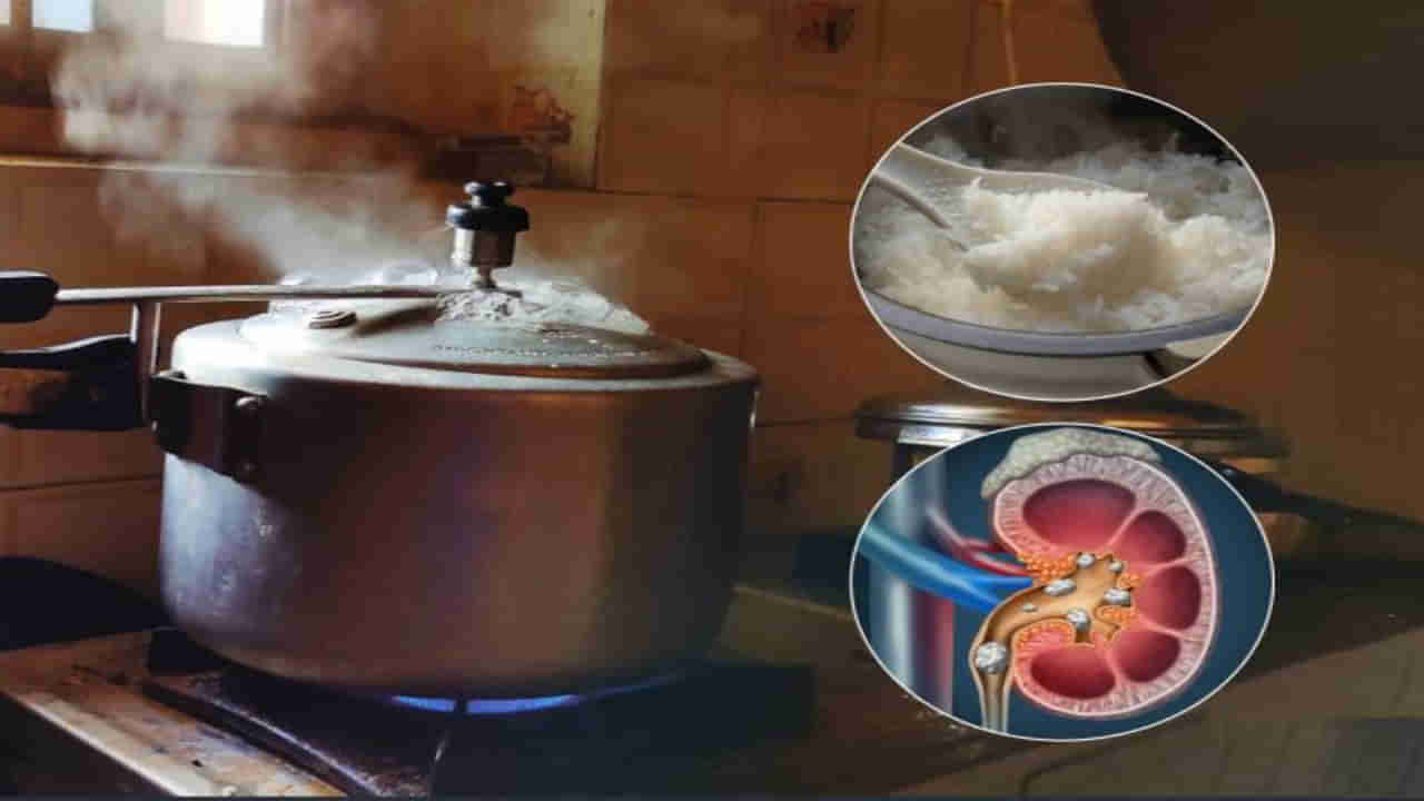 Pressure Cooker: ప్రెజర్ కుక్కర్‌లో వీటిని వండితే మీ పని మటాషే.. అవేంటో తెలుసుకోండి..