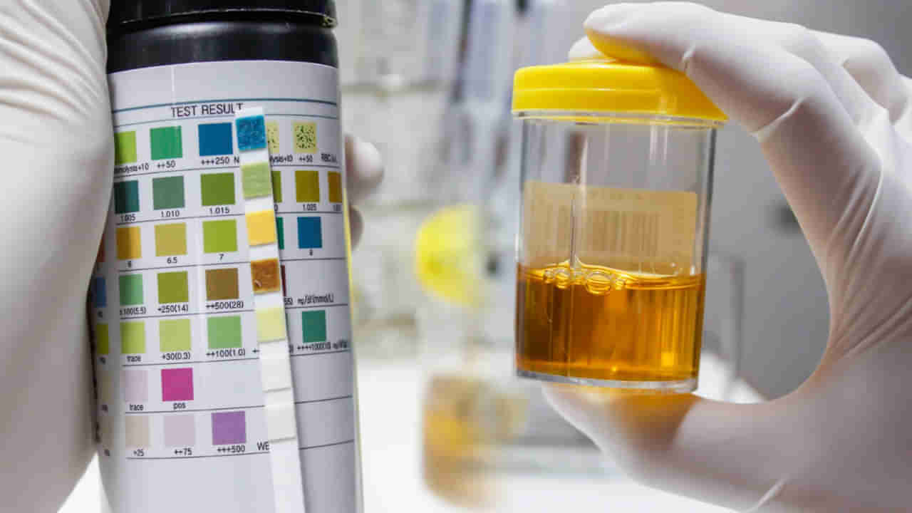 Urine Colour Alert: మీ మూత్రం మూత్రపిండాల ఆరోగ్యాన్ని చెబుతుందని తెలుసా..! ఈ రంగులో కనిపిస్తే కిడ్నీలు డేంజర్‌లో ఉన్నట్లే..