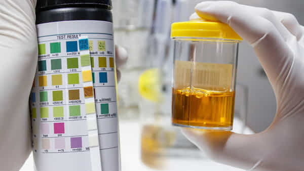Urine Colour Alert: మీ మూత్రం మూత్రపిండాల ఆరోగ్యాన్ని చెబుతుందని తెలుసా..! ఈ రంగులో కనిపిస్తే కిడ్నీలు డేంజర్లో ఉన్నట్లే..