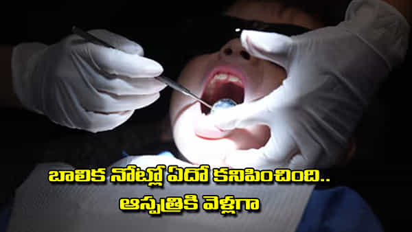 Viral: బాలిక నోట్లో ఏదో నల్లటి దారంలా కనిపించింది.. పరుగు పరుగున ఆస్పత్రికి వెళ్లగా..