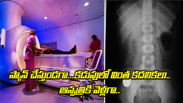 Viral: MRI స్కాన్ తీస్తుండగా కడుపులో వింత కదలికలు.. ఆస్పత్రికి పరుగు పరుగున వెళ్లగా..