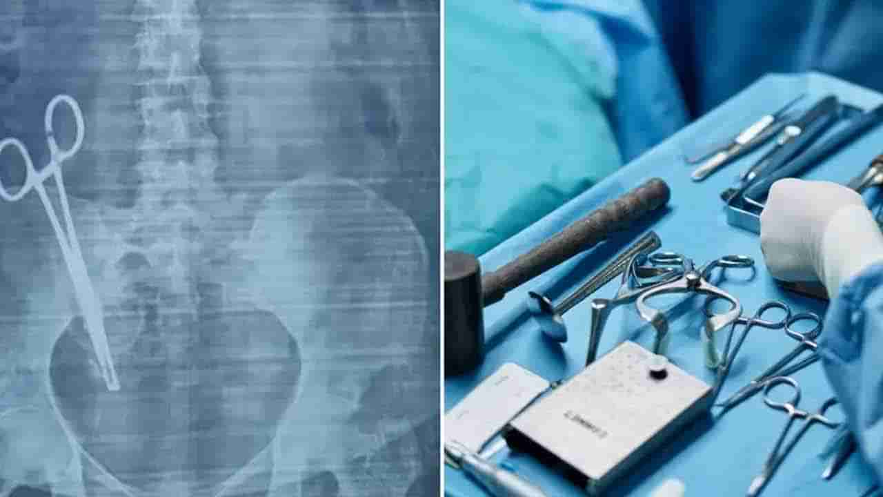 17ఏళ్లుగా తీవ్రమైన కడుపునొప్పితో బాధపడుతున్న మహిళ.. ఎక్స్‌రే చేసిన వైద్యులు షాక్‌..! పొట్టలో ఉన్నది చూస్తే..