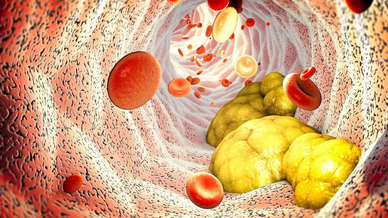 Bad Cholesterol: శరీరంలో చెడు కొలెస్ట్రాల్ కరిగిపోవాలంటే తప్పక తినాల్సిన ఆహారాలు..!