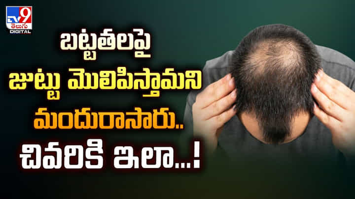 బట్టతలపై జుట్టు మొలిపిస్తామని మందురాసారు..చివరికి ఇలా...! బట్టతలపై జుట్టు మొలిపిస్తామని మందురాసారు..చివరికి ఇలా...!